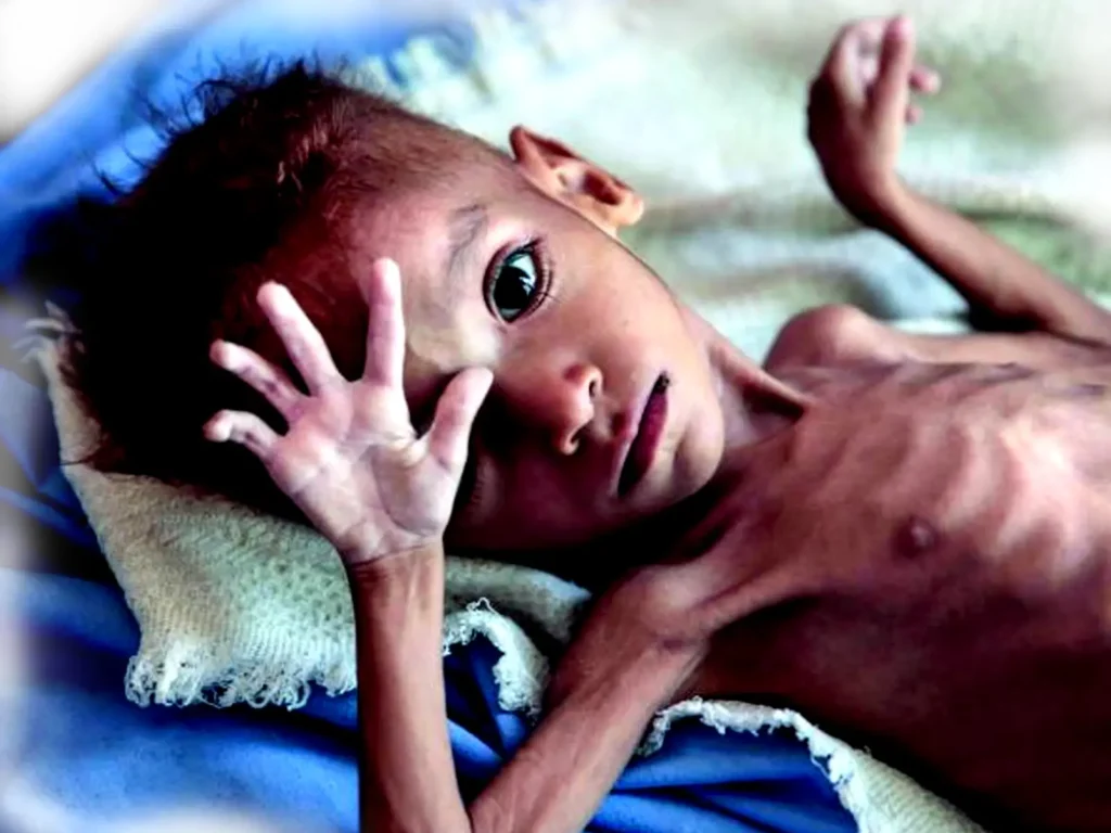 Malnutrition-Clinic-1-1024x768